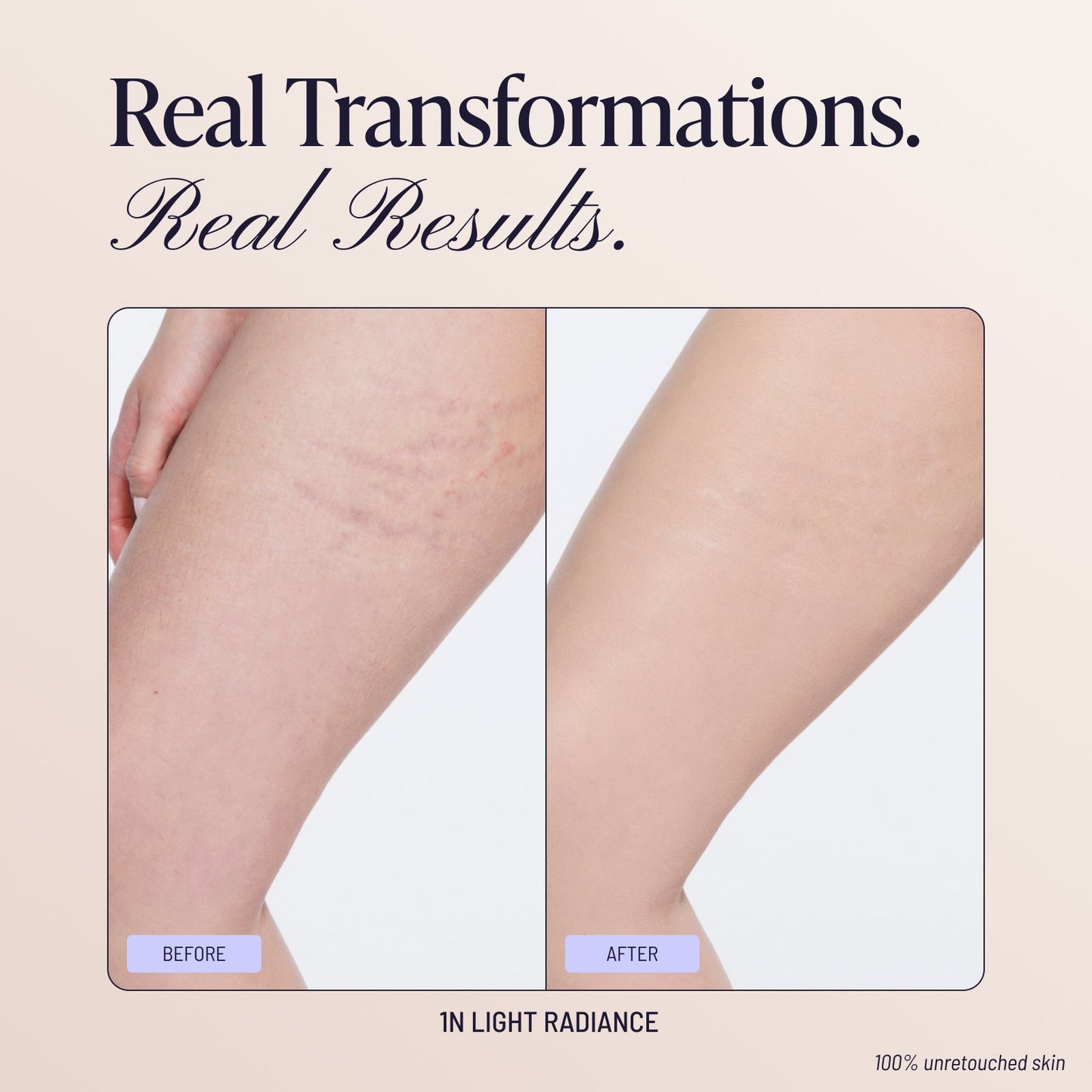 Body Coverage Perfector
