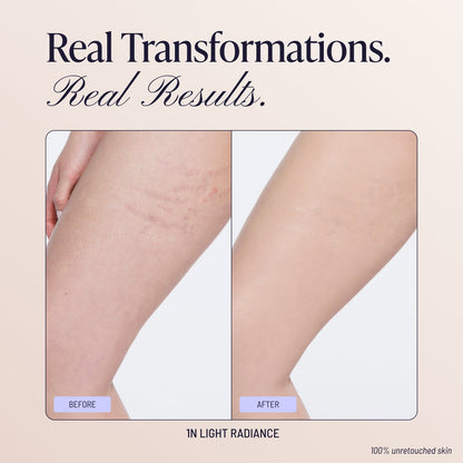 Body Coverage Perfector